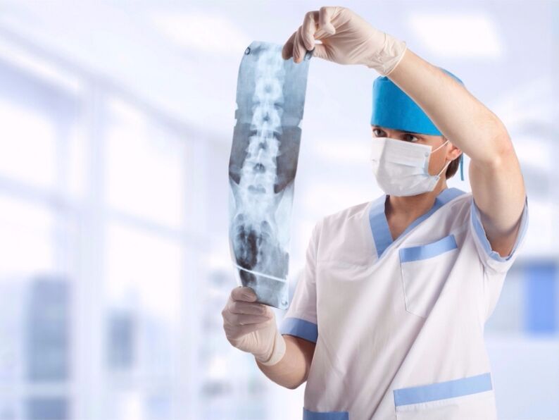 lekár sa pozrie na snímku krčnej chrbtice s osteochondrózou