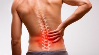 Príznaky a príznaky osteochondrózy bedrovej chrbtice