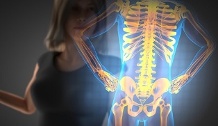 príznaky osteochondrózy chrbtice