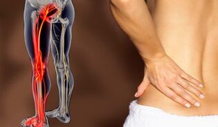 Vlastnosti bolesti chrbta
